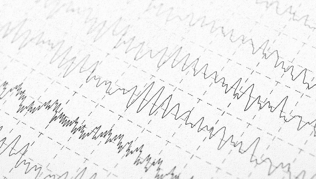 neurofeedback-brainwaves